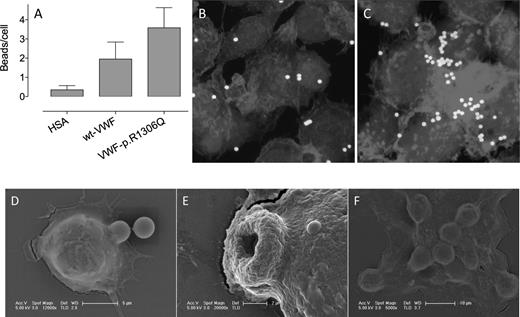 Figure 2. Uptake of p.R1306Q-coated beads by macrophages. Fluoresbrite-YG microspheres (1 × 104 beads per well) coated with HSA, wt-rVWF, or p.R1306Q-rVWF (25 μg/L × 104 beads) were incubated with PMA-stimulated THP-1 cells adhered to glass coverslips for 1 hour at 37°C. Subsequently, cells were thoroughly washed to remove nondigested beads. The number of phagocytosed beads was quantified via microscopic analysis and is expressed as beads per cell (A). Data represent the mean ± standard deviation of 2 independent experiments, in which at least 3 microscopic fields were analyzed. (B-C) Representative images of wt-rVWF–coated and p.R1306Q-coated beads phagocytosed by THP-1 macrophages. (D-F) Scanning electron images of macrophages phagocytosing microspheres coated with p.R1306Q-rVWF. (D) The first moment of capturing a VWF-coated bead. (E) A 3-μm hole through which a bead has been phagocytosed. (F) A macrophage that has phagocytosed multiple beads.