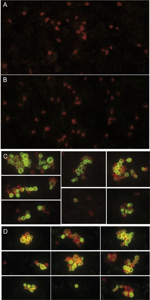 Figure 3. VWF/platelet complexes circulate in the blood of VWD type 2B mice. Blood smears prepared with blood collected from mice expressing either wt-mVWF (A), p.R1306Q-mVWF (B-C), or p.V1316M-mVWF (D). Mice had normal or slightly low platelet counts (A-B) or were thrombocytopenic (C-D). Platelets were detected by staining for the CD41 surface marker (red), and VWF (green) was detected with primary rabbit anti-human VWF antibody followed by a secondary AlexaFluor 488–goat anti-rabbit antibody. Original magnification is ×100. (A-B) Single platelets can be observed, and no VWF at the platelet surface could be detected. (C-D) Thrombocytopenic mice display circulating single platelets and platelet aggregates, both of which are characterized by the presence of VWF at the platelet surface.