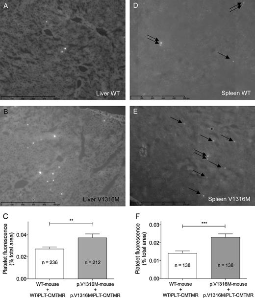 Figure 6. Quantification of wt-platelet or V1316M-platelet recovery in liver and spleen of wt-expressing and p.V1316M-mVWF–expressing mice. Liver (A-B) and spleen (D-E) cryosections were prepared as described in the legend of Figure 5 and scanned with a NanoZoomer. Images comprising whole sections were generated via virtual microscopy technology using NDPview software. Quantification (C,F) was performed using ImageJ software and is expressed as the percentage of surface covered by fluorescent spots (corresponding to fluorescent platelets) per field. Data represent mean ± SEM. The number of fields analyzed is indicated. **P = .0098; ***P = .0002. Representative images for cryosections of liver (A-B) and spleen (D-E) obtained from wt-mVWF–expressing mice (A-D) or p.V1316M-mVWF–expressing mice (B-E) are shown. Arrows point to fluorescent spots.