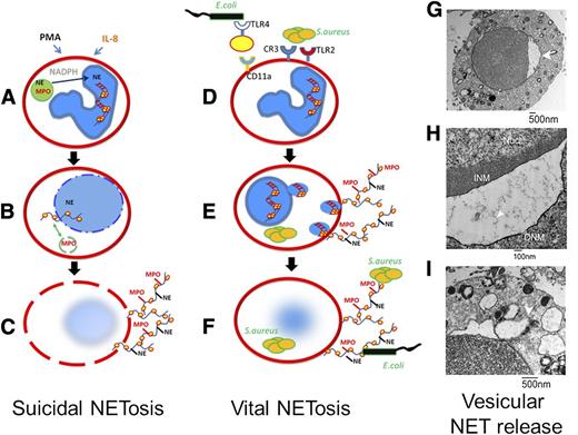 Figure 2. Suicidal NETosis vs vital NETosis. (A-C) Suicidal NETosis classically occurs following stimulation by PMA through activation of protein kinase C and the raf–mitogen-activated protein kinase (MEK)–extracellular signal-regulated kinase (ERK) pathway. NADPH assists in the translocation of neutrophil elastase from cytosolic granules into the nucleus where it aids in chromatin breakdown via histone cleavage. MPO is required for chromatin and nuclear envelope breakdown and granular mixing within the NET vacuole. Following 120 minutes of intracellular NET formation, the neutrophil outer membrane ruptures, and the mature NET is extruded. (D-F) By contrast, vital NETosis has been reported following both direct microbial exposure and lipopolysaccharide (LPS). Live S aureus induce rapid NET release (<30 minutes) in human and mouse neutrophils in vitro and in vivo. For gram-negative bacteria, NETs are induced via Toll-like receptor (TLR) 4 activation of platelets followed by direct neutrophil-platelet interaction via CD11a, whereas both complement receptor 3 and TLR2 are required for vital NETosis following gram-positive infection. NETs are released via nuclear budding (G-H) and vesicular release of NETs (I). This mechanism spares the PMN outer membrane, thereby allowing the PMN to continue to function, even to the point of becoming anuclear. (Panels G-I were reproduced from Pilsczek et al14 with permission (© 2010 by The American Association of Immunologists).