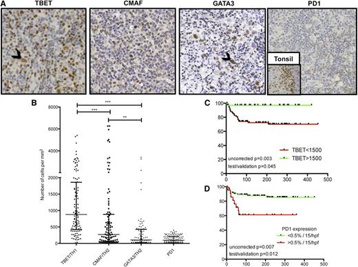Figure 4. Immunohistochemistry to investigate TBET, CMAF, GATA3, and PD1 expression. Photomicrographs (×40 objective, Olympus BX61 microscope) of representative examples (A) showing median expression of TH1-associated TBET (extreme left, black arrowhead showing TBET+ HRS cell) and TH2-associated CMAF (center left) and GATA3 (center right, black arrowhead showing GATA3+ HRS cell). PD1 expression was undetectable in most cases with the example (extreme right) being one of the few cases with >15 cells/high-power field associated with adverse outcome. Expression is weak compared with the internal positive control of tonsil (inset). Numbers of cells expressing each TH-associated marker and PD1 are compared (B) showing TH1-associated TBET is expressed by greater numbers of cells compared with TH2-associated CMAF/GATA3 and with minimal PD1 expression. DSS curves indicate a positive impact of TBET expression (C) and a negative impact of PD1 expression (D) in univariate analysis.