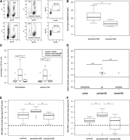 Figure 1. Analysis of circulating plasmablast and plasma cells, polyclonal immunoglobulin levels, and EBV DNA levels in HIV-infected patients with transient MG or persistent MG. (A) Gating strategy and phenotypes of circulating plasmablast and plasma cells. Circulating cells were stained with CD19, CD20, CD27, and CD138 monoclonal antibodies. Plasmablasts were identified as CD19+, CD20–, CD27+, and CD138– cells. Plasma cells were identified as CD19+, CD20–, CD27+, and CD138+ cells. Plasma cells are large cells expressing higher levels of CD27 than memory B cells. Circulating plasma cells represented 0.1% to 5% of B cells in HIV-infected patients. (B) Plasmablasts and plasma cells in the blood of transient MG, persistent MG, and control patients. Percentage of plasmablasts and plasma cells among CD19+ B cells were determined. (C) Polyclonal immunoglobulin levels in patients with persistent and transient MG. Serum levels of gammaglobulins were determined by protein electrophoresis at least after 5 years of follow-up under ART. (D) EBV DNA load in plasma (Log copies/mL). (E) EBV DNA load in B cells (Log copies/106 cells), numbers near plots indicate corresponded HIV RNA load. (F) EBV DNA in B-cell culture supernatant after 48 hours of culture. The ends of the boxes indicate the 25th and 75th percentiles, with a line at the median; error bars represent the 10th and 90th percentiles. **P < .05; *P > .05.