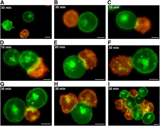 Figure 6. Fluorescence microscopy showing epratuzumab-induced trogocytosis. Purified monocytes labeled with PKH26-Red fluorescence were mixed 1:1 with Daudi cells labeled with PKH67-Green fluorescence and treated with labetuzumab (A-B) or epratuzumab (C-I) at 10 µg/mL. Fluorescent images were captured with an Olympus BX66 microscope (Shinjuko, Tokyo, Japan) equipped with a Mercury-100W laser (Chiu Technical Corp., Kings Park, NY), using an Olympus ×40/0.75 air objective lens and a Kodak DC290 Camera (Rochester, NY) set at ×115 zoom. A WB filter was used to allow simultaneous fluorescence of both red and green fluorochromes. Images were captured and processed using Adobe Photoshop CS3 v10 software with a Kodak Microscopy Documentation System 290 plug-in application. Incubation times are indicated on each panel. Bars represent 5 µm. Images were obtained from 1 of 3 repeat experiments, which gave reproducible results.