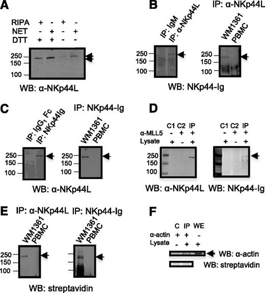 Figure 2. NKp44L immune-detection. (A) Direct western blot in the presence of nonreduced or reduced lysates. Proteins from Jurkat cells were extracted with radioimmunoprecipitation assay (RIPA) or NET buffer, treated or untreated with DTT, resolved on an 8% SDS-PAGE and then immunoblotted with anti-NKp44L mAb (αNKp44L). (B-C) Cell lysates from WM1361 cells and PBMCs were immunoprecipitated with anti-NKp44L mAb or the NKp44-Ig fusion protein, and then either (B) immunoblotted with the NKp44-Ig fusion protein or (C) anti-NKp44L mAb (αNKp44L). (B-C) Immunoprecipitations with isotype control are shown in the left panels. (D) WM1361 cell lysates were immunoprecipitated with the anti-N-ter polyclonal MLL5 Ab and immunoblotted with anti-NKp44L mAb (αNKp44L) or the NKp44-Ig fusion protein. C1 and C2 are controls obtained without lysate and without anti-MLL5 Ab, respectively. (E) Cell extracts from biotinylated WM1361 cells or PBMC were immunoprecipitated with anti-NKp44L mAb (αNKp44L) (left panel) or the NKp44-Ig fusion protein (right panel), and then immunoblotted with horseradish peroxidase-streptavidin. (F) Control Immunoprecipitation (IP) after cell-surface biotinylation of WM1361 cells. Cell extracts were immunoprecipitated with anti-actin mAb (α−actin) and then either immunoblotted with horseradish peroxidase-streptavidin (lower panel) or anti-actin mAb (α−actin) (higher panel). Nonimmunoprecipitated whole extract (WE) was immunoblotted with anti-actin mAb (α−actin). (C) Control obtained without lysate. IP, immunoprecipitation; WB, western blot. An arrow indicates the specific band.