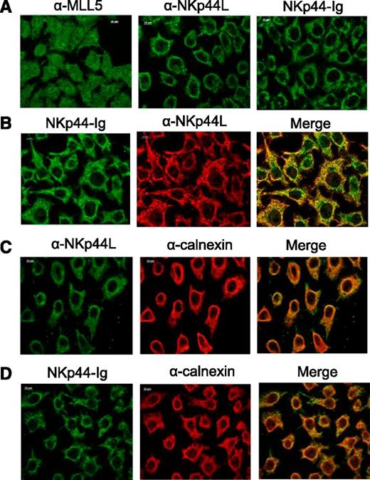 Figure 4. Cellular localization of NKp44L in tumor cells. Immunofluorescence microscopy was performed on acetone-fixed HeLa cells stained with anti-MLL5 Ab (αMLL5), anti-NKp44L mAb (αNKp44L), or NKp44-Ig fusion protein. (A) Cytoplasmic and nuclear staining. (B) Intracellular colocalization of NKp44L and NKp44-Ig. (C-D) Intracellular colocalization of calnexin (α−calnexin) either with NKp44L (C) or NKp44-Ig fusion protein (D).