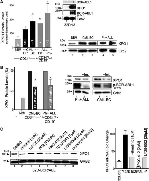 Figure 1. XPO1 expression is enhanced in Ph+ acute leukemia (CML-BC and B-ALL) progenitors. (A) Top right panel: XPO1 and BCR-ABL1 protein levels in BCR-ABL1- or empty vector–transduced 32Dcl3 myeloid cells were determined by immunoblot. Left panel: Protein levels of XPO1 expressed as mean ± standard error of the mean (SEM) of densitometric units after normalization with Grb2 levels, were determined by immunoblot of NBM (n = 7), CML-CP (n = 3), and CML-BC (n = 7) CD34+ progenitors, and Ph+ B-ALL (n = 5) and Ph− B-ALL (n = 4) CD34+/CD19+ progenitors. Bottom right panel: Sample of immunoblots used to determine XPO1 protein levels used for quantification. (B) Left panel: XPO1 protein levels expressed as mean ± SEM in vehicle- or imatinib-treated (1 µM, 12 hours) CML-BC CD34+ cells and Ph+ B-ALL CD34+/CD19+ cells. Right panel: Representative immunoblot of XPO1 protein levels and BCR-ABL1 activity (anti-PY) in vehicle- or imatinib-treated (1 µM, 12 hours) Ph+ B-ALL CD34+/CD19+ (lanes 1 and 2) and CML-BC CD34+ (lanes 3 and 4) cells. (C) Left panel: XPO1 protein levels in 32D-BCR/ABL cells treated (24 hours) with the indicated kinase inhibitors. Right panel: XPO1 mRNA levels assessed by quantitative reverse-transcription PCR in 32Dcl3 and untreated and kinase inhibitor–treated (24 hours) 32D-BCR/ABL cells. Asterisks indicate P values vs NBM; *P < .05, **P < .01.