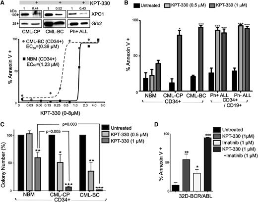 Figure 2. KPT-330 decreased survival and clonogenic potential in CML-BC and Ph+ B-ALL cells. (A) Top panel: Representative (n = 3) western blot showing XPO1 protein levels in vehicle- or KPT-330–treated (1 µM, 72 hours) CD34+ CML-CP and CML-BC, and CD34+/CD19+ Ph+ ALL progenitor cells. Numbers above the blots indicate relative densitometric units. Bottom panel: Graph shows percentage of apoptosis (annexin V+) in vehicle- or KPT-330–treated (0-8 µM, 72 hours) NBM and CML-BC CD34+ cells. EC50 was calculated as described in “Methods.” (B) Graph shows percentage of annexin V+ cells (mean ± SEM) in vehicle- and KPT-330 (0.5-1 µM, 72 hours)–treated NBM (n = 3), CML-CP (n = 3) and CML-BC (n = 3) CD34+ BM cells, and CD34+/CD19+ Ph+ B-ALL (n = 3) and Ph− B-ALL (n = 3) BM cells. (C) Colony-forming ability of vehicle- or KPT-330–treated (0.5-1 µM, 72 hours) NBM (n = 3), CML-CP (n = 3), and CML-BC (n = 3) CD34+ BM cells. Clonogenic potential, shown as mean ± SEM, was normalized to the respective untreated sample. (D) Annexin V+ cells (mean ± SEM) in 32D-BCR/ABL cells treated with KPT-330 (1 µM, 24 hours) and imatinib (1 µM, 24 hours) used alone or in combination. Significance was determined using the Student t test of 3 identical experiments. Asterisks indicate P values vs NBM; *P < .05, **P < .01, ***P < .001.