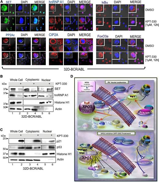 Figure 3. KPT-330 treatment alters the subcellular localization of tumor suppressors and negative regulators of PP2A. (A) Single-channel and merged confocal micrographs of 32D-BCR/ABL cells treated with vehicle or KPT-330 (1 µM, 12 hours) and stained with anti-SET, anti-PP2Ac, anti-hnRNP A1, anti-CIP2A, anti-IkBα, or anti-FoxO3a antibody (left panels; green or red), 4,6 diamidino-2-phenylindole (middle; blue), and merged (right). SET and hnRNP A1 (B), and p21 and p53 (C) protein levels in nuclear and cytoplasmic subcellular fractionated extracts from vehicle- and KPT-330–treated (1 µM, 12 hours) 32D-BCR/ABL cells. Histone H1 and Grb2 levels were used as a control for purity of nuclear and cytoplasmic fractions, respectively. (D) KPT-330–mediated XPO1 inhibition abrogates leukemogenesis by altering nuclear/cytoplasmic shuttling. In Ph+ acute leukemia progenitors, XPO1 expression is increased at least in part through a BCR-ABL1 kinase-dependent mechanism, and is responsible for nuclear export of the SET oncogene and CIP2A, and for the nucleocytoplasmic shuttling activity of hnRNP A1, a regulator of SET mRNA metabolism. SET and CIP2A are BCR-ABL1/Jak2- and BCR-ABL1-regulated inhibitors of the PP2A tumor suppressor, respectively. In these cells, XPO1 activity also controls the subcellular localization of important regulators of cell survival as p53, p21, IκBα, and FoxO3a. Bottom panel: On inhibition of XPO1 activity with the SINE KPT-330, the SET and CIP2A proteins are sequestered in the nucleus, which leads to activation of PP2A that, in turn, triggers inhibition/degradation of BCR-ABL1 contributing to cell death. Cytoplasmic accumulation of hnRNP A1 also contributes to the decreased SET levels. In addition, nuclear accumulation of p53, p21, IκBα, and FoxO3a also likely contribute to impair leukemogenesis of Ph+ acute leukemia progenitors.