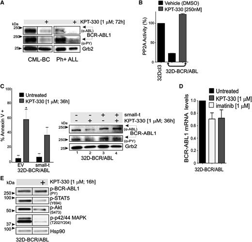 Figure 4. KPT-330 treatment increases PP2A activity and downregulates BCR-ABL1 expression and activity. (A) Representative (n = 3) western blot showing BCR-ABL1 activity (anti-PY) and expression (anti-ABL) in vehicle- and KPT-330–treated CD34+ CML-BC cells and CD34+/CD19+ Ph+ ALL cells. (B) PP2A activity in 32Dcl3 (positive control), vehicle- and KPT-330–treated (250 nM; 48 hours) 32D-BCR/ABL cells. PP2A activity was normalized to 32Dcl3 cells. (C) Left panel: Graph shows percentage of apoptotic cells (annexin V+) in vehicle- or KPT-330–treated (1 µM, 36 hours) parental and small-t–expressing 32D-BCR/ABL cells. Significance was determined using the Student t test of 3 identical experiments. Asterisks indicate P values vs untreated; *P < .05. Right panel: BCR-ABL1 activity (anti-PY) and expression (anti-ABL) in vehicle- and KPT-330 (1 µM, 24 hours)–treated parental and small-t–expressing 32D-BCR/ABL cells. (D) Quantitative reverse-transcription PCR shows BCR-ABL1 mRNA levels in untreated, imatinib (1 µM, 24 hours)–treated, and KPT-330 (1 µM, 24 hours)–treated 32D-BCR/ABL1 cells. (E) Western blot shows effect of KPT-330 (1 µM, 16 hours) on the activity of BCR-ABL1 (anti-PY), STAT5 (anti-pSTAT5Y694), Akt (anti-pAktS473), and p42/44 MAPK (anti-pMAPKT202/Y204). Heat shock protein 90 was used as a control for equal loading.