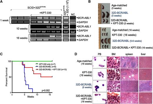 Figure 5. KPT-330 treatment increases survival time of leukemic mice. (A) Nested RT-PCR for BCR-ABL1 mRNA in the PB measured 1, 10, and 16 weeks after injection. PB of age-matched mice (NC) and a 1:106 dilution of 32D-BCR/ABL cells with 32Dcl3 cells were used as negative and positive controls, respectively. GAPDH mRNA levels were used as a control. (B) Gross anatomy of spleens isolated from vehicle- and KPT-330–treated (15 mg/kg, 2 times weekly) mice injected with 32D-BCR/ABL cells, age-matched controls, and/or KPT-330 only–treated mice at 5 weeks (top panel) and 16 weeks (bottom panel) after cell-injection. (C) Kaplan-Meier curve shows effect of KPT-330 treatment (15 mg/kg, 2 times weekly) on survival of SCID mice injected with 32D-BCR/ABL cells (n = 10, red line). Untreated mice injected with cells (n = 8, blue line) or KPT-330–treated mice that did not receive cells (n = 7, green line) were used as controls. Survival was calculated by the Kaplan-Meier method, and the log-rank test evaluated the differences among survival distributions: P = .002 (32D-BCR/ABL–untreated vs 32D-BCR/ABL KPT-330–treated mice). (D) Wright/Giemsa staining of PB and H&E staining of sections from the BM, spleen, and liver of untreated and KPT-330–treated control and cell-injected mice.