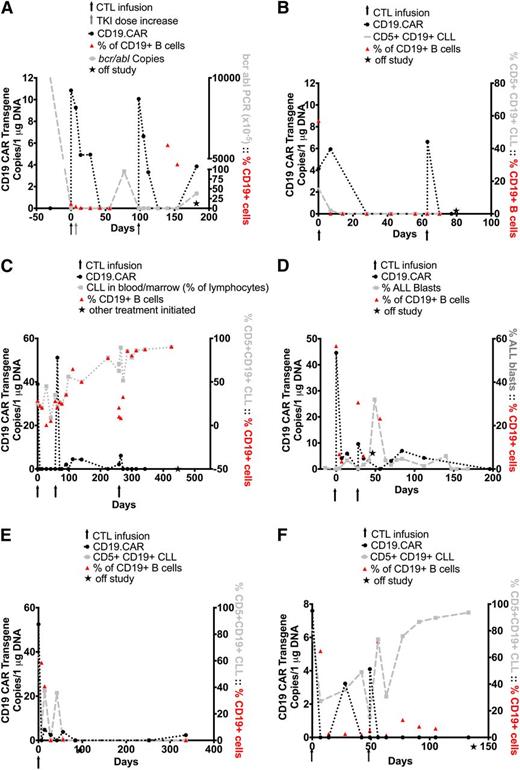 Figure 2. Outcome after CD19.CAR-VST infusions in patients infused with disease. Panels A-F represent single patients. Panels A-C illustrate patients with sustained objective clinical response, and panels D-F illustrate patients with transient or no response. In all panels, black arrows denote the time of CD19.CAR-VST infusions, black circles indicate the detection of CD19.CAR-VSTs in the PB by Q-PCR, and red triangles represent the values of normal B-cell counts in the PB. (A) Data from patient 1. Detection of bcr/abl transcripts are indicated as light gray squares. The gray arrow indicates the increase in dose of dasatinib (TKI). (B-C) Data from patients 2 and 3, respectively. In both subjects, circulating B-CLL cells (CD19+CD5+) were measured by flow cytometry and are shown as light gray squares. (D-F) Data from patients 4, 5, and 6, respectively. Leukemic cells, measured in the PB by flow cytometry, are represented as light gray squares. The star indicates the time when patients received additional/alternative treatments or were considered out of study.