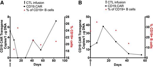 Figure 3. Outcome after CD19.CAR-VST infusions without evidence of disease. Each panel represents a single patient. In all panels, black arrows denote the time of CD19.CAR-VST infusions, black circles indicate the detection of CD19.CAR-VSTs in the PB by Q-PCR, and red triangles represent the values of normal B-cell counts in the PB. (A-B) Data from patients 7 and 8 who received CD19.CAR-VSTs 8 months and 3 months after allogeneic HSCT, respectively.