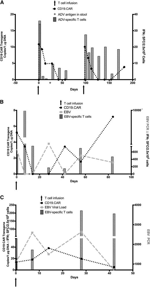 Figure 5. Viral reactivation. (A) AdV reactivation and monitoring of the specific immune response in patient 1. Detection of AdV-specific T-cell responses by IFNγ ELISpot (striped bars) and CD19.CAR transgene by Q-PCR (black circles) are illustrated. The light gray diamond denotes the time of adenovirus antigen detection in stool. (B-C) EBV reactivation and immune responses in patients 7 and 8, respectively. Detection of EBV-DNA viral load by Q-PCR (light gray squares), CD19.CAR transgene by Q-PCR (black circles), and EBV-specific T-cell responses (striped bars) by IFNγ ELISpot in the PB are illustrated. Arrows denote time of CD19.CAR-VSTs infusions.