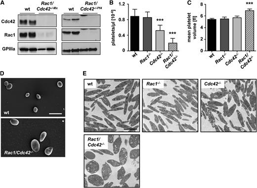 Figure 1. Absence of Rac1 and Cdc42 leads to macrothrombocytopenia. (A) Western blot analysis of Rac1 and Cdc42 expression in wild-type (wt) and Rac1/Cdc42−/− platelets generated by the Mx-Cre (left) or the PF4-Cre (right) system. GPIIIa expression was used as loading control. Analysis of peripheral platelet counts (B) and mean platelet volume (C) of wt (black), Rac1−/− (dark gray), Cdc42−/− (light gray), and Rac1/Cdc42−/− (patterned) mice (n = 5 per group; ***P < .001). (D-E) Rac1/Cdc42−/− platelets are increased in size. Representative scanning (D) and transmission (E) electron microscopy pictures from wt and Rac1/Cdc42−/− platelets are depicted. Bars, 5 and 2 µm.