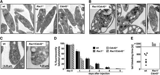 Figure 2. Rac1/Cdc42−/− platelets display abnormal ultrastructure and are rapidly cleared from the circulation. (A-B) Representative TEM pictures are shown. (A) Normal ultrastructure of wt, Rac1−/−, and Cdc42−/− platelets. Bar, 0.5 µm. (B) Abnormal ultrastructure of Rac1/Cdc42−/− platelets. Bar sizes are depicted. (C) Increased number of marginal microtubular rings in Rac1/Cdc42−/− platelets. Bar sizes are depicted. (D) Life span from Rac1−/− (dark gray), Cdc42−/− (light gray), and Rac1/Cdc42−/− (patterned) platelets compared with wt (black) platelets. (E) Infinite tail bleeding times in Rac1/Cdc42−/− (patterned) compared with wt (black) mice (n = 7 per group; ***P < .001).