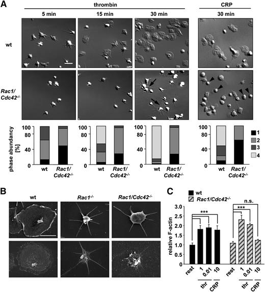 Figure 3. Defective spreading of Rac1/Cdc42−/− platelets on fibrinogen upon activation. (A) Washed platelets from wt and Rac1/Cdc42−/−Mx mice were allowed to adhere on immobilized human fibrinogen (100 µg/mL) upon activation with thrombin (0.01 U/mL, left) or CRP (10 µg/mL, right). (Upper) DIC images were taken at the indicated times (5, 15, and 30 minutes), representative of 4 individual experiments. Bar, 5 µm. (Lower) Statistical analysis of the percentage of spread Rac1/Cdc42−/−Mx and wt platelets. (Bottom) (1) Roundish, no filopodia, no lamellipodia. (2) Only filopodia. (3) Partial spreading. (4) Full spreading. Arrows indicate altered morphology in Rac1/Cdc42−/−Mx platelets. (B) Visualization of defective spreading and actin reorganization of Rac1−/− (middle) and Rac1/Cdc42−/−Mx (right) platelets by scanning electron microscopy. (Upper) Scanning electron microscopy image of intact platelets. (Lower) Visualization of the cytoskeleton after denudation of the plasma membrane. Bar, 2 µm. (C) Determination of relative F-actin contents in resting, thrombin-activated (1 and 0.01 U/mL), and CRP-activated (10 µg/mL) wt (black) and Rac1/Cdc42−/−Mx (patterned) platelets (n = 4 per group; ***P < .001).