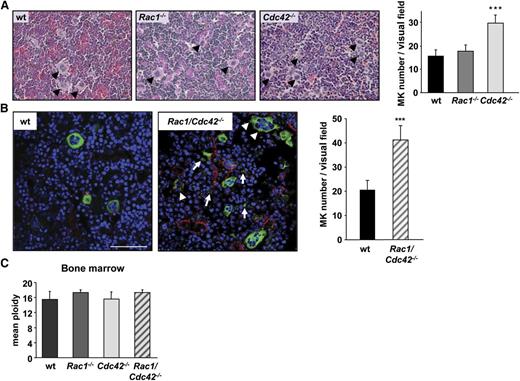 Figure 4. Increased MK numbers in BM of Cdc42−/− and Rac1/Cdc42−/− mice. (A) Determination of MK numbers in hematoxylin and eosin–stained BM sections from wt (black), Rac1−/− (dark gray), Cdc42−/− (light gray), and Rac1/Cdc42−/− (patterned) mice. (Left) Representative images. (Right) Statistical analysis. (B) Determination of MK number and morphology within the BM of anti–CD41-stained (green) cryosections. Endothelial cells are stained with anti-CD105 (red) and nuclei with 4,6 diamidino-2-phenylindole (DAPI) (blue). Results are expressed as mean MK number per visual field ± SD of 3 mice per group. (C) Functional endomitosis in Rac1−/−, Cdc42−/−, and Rac1/Cdc42−/− MKs. Determination of the mean ploidy of BM-derived MKs from wt (black), Rac1−/− (dark gray), Cdc42−/− (light gray), and Rac1/Cdc42−/− (patterned) mice. Results are expressed as mean ploidy ± SD (n = 4 per group; ***P < .001).