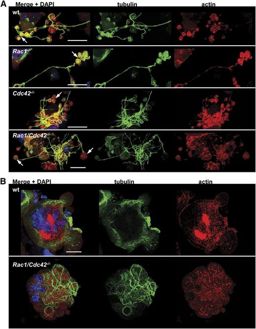 Figure 6. Altered tubulin structure in Rac1/Cdc42−/− MKs. (A-B) Analysis of actin and tubulin structure by confocal microscopy. Representative stainings for actin (red), tubulin (green), and DAPI (blue) from at least 3 different samples per group are shown. (A) Visualization of proplatelets from wt (upper), Rac1−/− (second), Cdc42−/− (third), and Rac1/Cdc42−/− (lower) MKs. Bar, 25 µm. (B) Start of proplatelet formation in mature wt (upper) and Rac1/Cdc42−/− (lower) MKs. Bar, 25 µm.