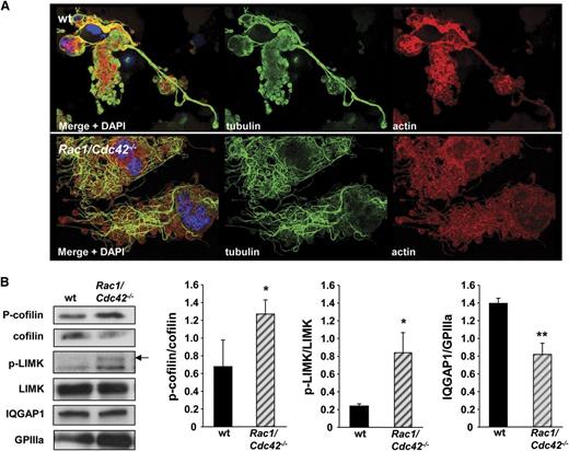 Figure 7. Altered tubulin structure in Rac1/Cdc42-/- MKs is associated with changes in cofilin activation. (A) Analysis of actin and tubulin structure in early proplatelet-forming MKs by confocal microscopy. Representative stainings for actin, tubulin, and DAPI from at least 3 different samples per group are shown. Bar, 25 µm. (B) Increased phosphorylation of cofilin and LIMK, and reduced expression level of IQGAP1 in Rac1/Cdc42−/− MKs. Western blot analysis of FLC-derived MKs. MKs on day 3 of culture were purified with a bovine serum albumin gradient, and protein lysates were obtained. Equal amounts of proteins were loaded, and the expression was detected with specific antibodies and quantified by densitometry with Image J software (National Institutes of Health). Shown blots are representative of at least 3 independent samples. **P < .01; *P < .05.