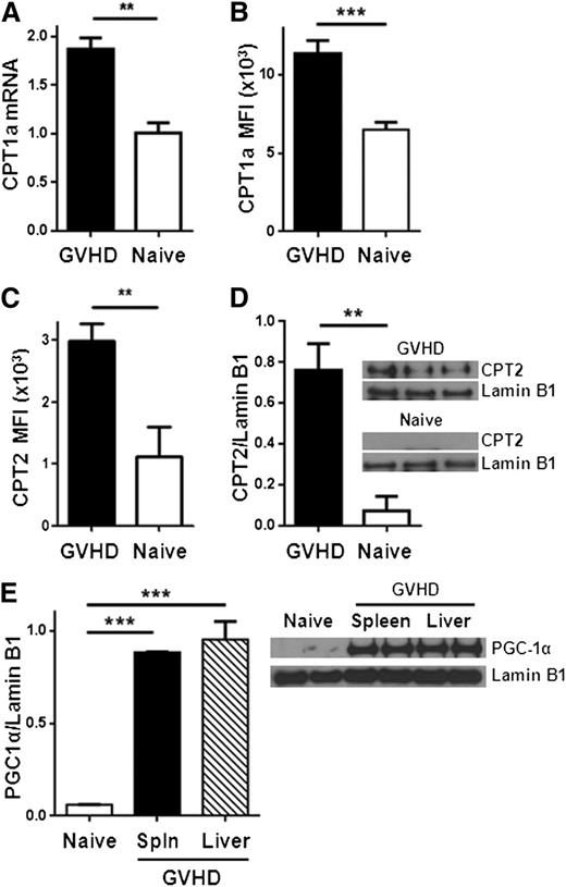 Figure 2. Allogeneic T cells up-regulate CPT1a, CPT2, and PGC1-α during GVHD. (A) Donor T cells were flow-sorted from either naïve donor animals or allogeneic recipients 7 days after BMT (GVHD) and levels of CPT1a quantitated by RT-PCR. (B) Median fluorescence intensity (MFI) of CPT1a in T cells following intracellular staining as described in Methods. Data represent 4 to 6 mice/group. (C) Intracellular CPT2 was measured by flow cytometry (supplemental Figure 4) and the results quantitated (n = 4/group). (D) Donor T cells (CD45.1+, TCR-β+, Annexin−) were flow-sorted and cell lysates probed for CPT2 by western blot. Shown is 1 of 3 independent experiments. (E) T-cell lysates from spleen or liver were purified by flow-sorting and probed by western blot for levels of PGC1-α. Each lysate was pooled from ≥3 mice. **P < .006, ***P < .0001.