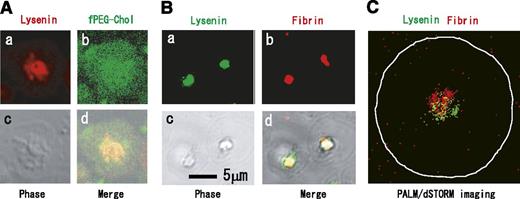 Figure 1. Immunocytochemical colocalization of fibrin(ogen) with sphingomyelin-rich rafts in central region of adhered platelets in the presence of thrombin. (A) (a) mCherry-lysenin-positive sphingomyelin (SM)-rich rafts (red), (b) fPEG-Chol-positive cholesterol-rich rafts (green), (c) phase-contrast cell morphology, (d) merged images of (a-c). (B) colocalization of fibrin (red) with green fluorescent protein–lysenin-positive SM-rich rafts (green). Scale bar, 5 μm. (C) Photoactivated localization microscopy and direct stochastic optical reconstruction microscopy (PALM/dSTORM) imaging of lysenin-positive SM-rich rafts (green) and fibrin(ogen) (red). The white line represents the shape of an adhered human platelet.