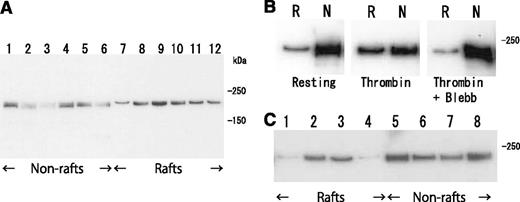 Figure 6. Transient translocation of myosin to DRM raft fraction. (A) Time-dependent translocation of myosin from nonraft fraction (lanes 1-6) to DRM raft fraction (lanes 7-12) in platelets by thrombin stimulation for 0 seconds (lanes 1 and 7), 30 seconds (lanes 2 and 8), 1 minute (lanes 3 and 9), 5 minutes (lanes 4 and 10), 15 minutes (lanes 5 and 11), and 60 minutes (lanes 6 and 12). Immunoblotting was performed with a myosin heavy-chain antibody. (B) ATPase-activity-dependent translocation of myosin to DRM raft fraction. Immunoblotting with antimyosin antibody of DRM raft fraction (lane R) and nonraft fraction (lane N) in resting platelets (left panel) and thrombin-stimulated platelets in the absence (middle panel) or presence (right panel) of 100 μM myosin ATPase inhibitor blebbistatin. (C) PAR-dependent translocation of myosin to DRM raft fraction. Immunoblotting with antimyosin antibody of DRM raft fraction (lanes 1-4) and nonraft fraction (lanes 5-8) in resting platelets (lanes 1 and 5) and platelets stimulated with 0.2 U/mL thrombin (lanes 2 and 6), 25 μM TRAP (lanes 3 and 7), and 20 μM adenosine 5′-diphosphate (lanes 4 and 8) for 3 minutes.