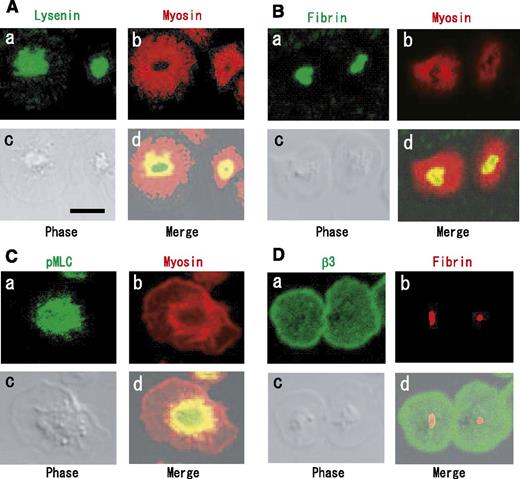 Figure 7. Immunocytochemical colocalization of myosin and Ser19-phosphorylated myosin light chain with fibrin on SM-rich rafts. (A) Localization of SM-rich rafts (green) and myosin (red). Scale bar, 5 μm. (B) Localization of fibrin (green) and myosin (red). (C) Localization of Ser19-phosphorylated MLC (green) and myosin (red). (D) Integrin β3 (green) and fibrin (red).