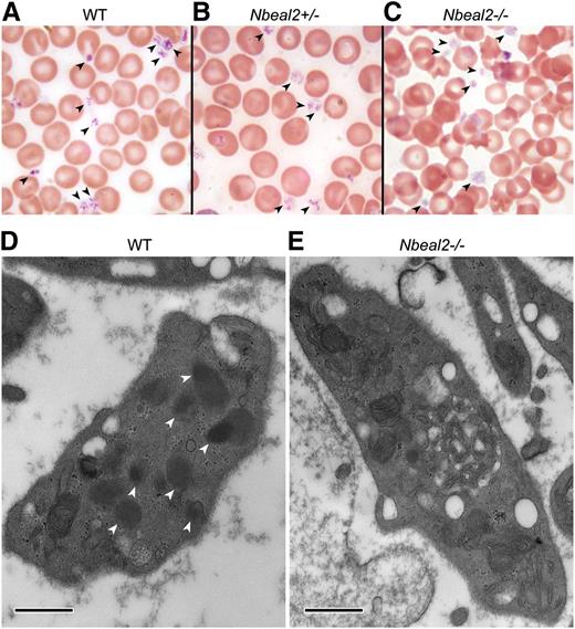 Figure 1. Blood film and ultrastructure abnormalities of Nbeal2−/− mouse platelets. Blood films were prepared from WT (A), Nbeal2+/− (B), and Nbeal2−/− (C) mice and stained with Wright-Giemsa stain prior to light microscopy. WT (A) and Nbeal2+/− (B) blood films show typical platelet (black arrowheads) size and morphology with discernible granulation against light cytoplasmic staining, and the Nbeal2−/− film (C) shows gray-appearing platelets with indistinct granulation and visible vacuoles. Thin-section transmission electron micrographs of representative platelets are from WT mice (D) and Nbeal2−/− mice (E). Multiple α-granules (white arrowheads) were evident in WT platelets and absent in Nbeal2−/− platelets, which are larger on average. Magnification ×40 000; scale bars represent 500 nm.