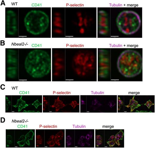 Figure 3. P-selectin in resting and thrombin-activated Nbeal2−/− platelets. High-resolution confocal laser immunofluorescence microscopy imaging of intracellular P-selectin membrane proteins in fixed resting platelets. Permeabilized cells were stained for α-tubulin (violet), P-selectin (red), and CD41/integrin αIIb (green) and imaged (final magnification = ×150, Z stepping = 250 nm). Single-channel and merged mid-cell ZY/XY slices of representative individual platelets are shown (A-B). Resting platelets from WT (A) and Nbeal2−/− (B) mice have similar flat, discoid morphology with a well-defined circumferential tubulin ring cytoskeleton. Both contain P-selectin, which defines compact looping structures of the α-granule secretory matrix typical of WT platelets that generally appear to be less orderly in Nbeal2−/− platelets. Thrombin activated WT (C) and Nbeal2−/− (D) platelets show characteristic activation-triggered changes in shape and surface mobilization of P-selectin.