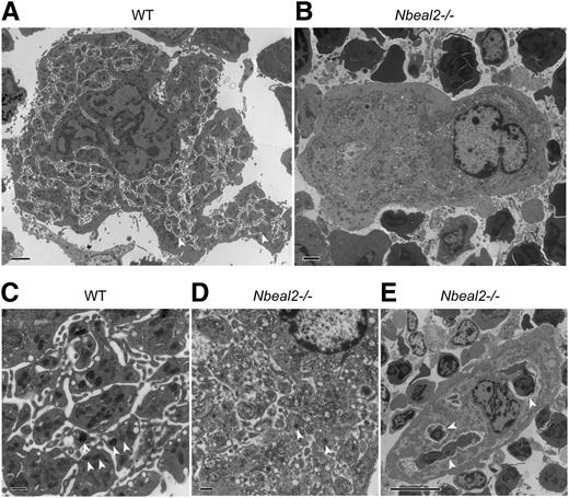 Figure 5. Abnormal ultrastructure of Nbeal2−/− bone marrow megakaryocytes. (A) Thin-section transmission electron micrographs of representative WT MKs show typical platelet territories (white arrowheads) and platelet-like structures containing α-granules. (B) In contrast, Nbeal2−/− MK are deficient in both α-granules and platelet territories (magnification ×4000, scale bars = 2 µm). (C) Higher-magnification (×15 000) images of WT MK reveal multiple α-granules (white arrowheads) and platelet territories, whereas (D) α-granules (white arrowheads) are rare in Nbeal2−/− MK, which show poorly defined platelet territories (scale bars = 500 nm). (E) Example of the emperipolesis that was frequently observed in Nbeal2−/− MK; here, 3 exogenous cells (white arrowheads) are present in the MK (magnification ×3000, scale bar = 10 µm).