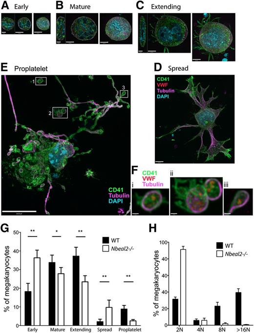 Figure 6. Abnormal Nbeal2−/− megakaryocyte development in populations of cultured bone marrow cells. Immunofluorescence images of megakaryocytes cultured to the terminal proplatelet stage. (A-E) Cells present in fixed 5-day cultures (n = 5 mice and 600 cells for both Nbeal2−/− and WT) were identified by immunofluorescence microscopy as MKs by size (>10 µm diameter), large/lobulated nuclei (light blue), and expression of lineage-specific CD41 (green) and VWF (red). Individual cells were classified by apparent developmental stage as (A) early, <20 µm in diameter (ZY sections show these cells to be spheroidal); (B) mature, >20 µm without projections (ZY sections show flattening with increased size); (C) extending, round cells with membrane projections; (D) spread, large cells with extensive membrane and tubulin (violet) projections but not showing clearly defined proplatelets; and (E) terminal proplatelets emanate from these very large megakaryocytes. (E) A distinctive pattern of nuclear retraction (light blue) and elaboration of nascent platelets defined by extensions of membrane (visualized by CD41, green) and cytoskeletal α-tubulin strands and loops (violet). (F) Higher-magnification views of nascent-free platelets (i,ii) and a proplatelet bud (iii) from the WT cell having the distinctive platelet tubulin cytoskeletal ring and the presence of VWF (red, not shown; E), which is absent in Nbeal2−/− platelets (Figure 2C). Panels A-C show left to right YZ (bars = 5 µm) and XY confocal midcell sections and extended focus images (bars = 10 µm); panels D,E show extended focus images (D scale bar = 10 µm; E scale bar = 20 µm; F scale bars = 1 µm). (G) Population distributions of mean proportions of cells in each stage showed significant differences between Nbeal2−/− and WT (*P < .05; **P < .01, 2-tailed t test), with Nbeal2−/− cultures showing a markedly higher proportion of cells in both the early and spread stages and fewer in the mature, extending, and proplatelet stages. (H) Distribution of Nbeal2−/− and WT CD41+ MK cells and ploidy (n = 3 per group) after 5-day cultured cells, revealing increased 2N and greatly reduced 8N and >16N Nbeal2−/− MKs.