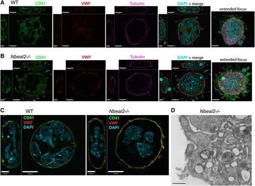 Figure 7. Abnormal VWF distribution in Nbeal2−/− megakaryocytes. (A) Immunofluorescence imaging of a representative permeabilized mature extending stage WT megakaryocyte shows elaboration of demarcation membranes stained with CD41 (green), dispersed VWF expression (red), and a peripheral tubulin cytoskeletal meshwork (violet). (B) A representative Nbeal2−/− MK at the same stage shows a strong peripheral distribution of VWF, which is absent in Nbeal2−/− platelets; this MK also contains the nucleus of an exogenous cell in its cytoplasm visible in the XZ view of the merged confocal panel. Comparisons of nonpermeabilized cells (C) confirm that VWF is abnormally concentrated near or on the surface of mature Nbeal2−/− megakaryocytes (scale bars in ZY panels = 5 µm; scale bars in XY, XZ, and extended focus panels = 10 µm). (D) Transmission electron micrograph of immunogold labeled VWF present on the surface of a Nbeal2−/− megakaryocyte. Magnification ×50 000; scale bar represents 500 nm.