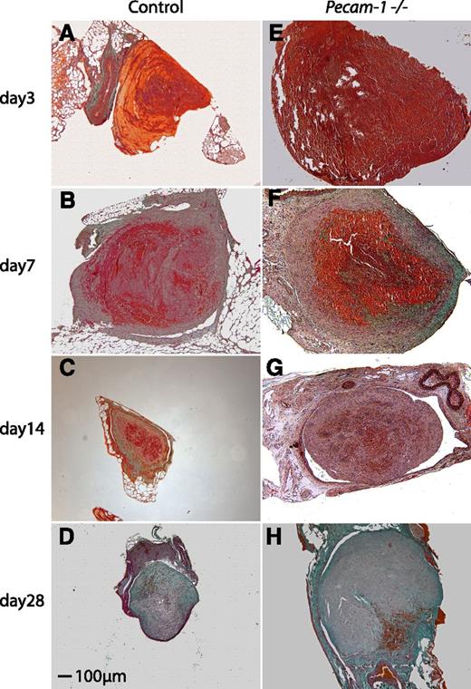 Figure 2. Trichrome stains of wild-type and Pecam-1−/− thrombi. Representative thrombus cross-sections of wild-type (A-D) and Pecam-1−/− (E-H) mice on days 3 (A,E), 7 (B,F), 14 (C,G), and 28 (D,H) after vena cava ligation are shown. Initially, thrombi are fibrin-rich (red) and fragile, and subsequently become solid due to increased collagen synthesis (green). Scale bar, 100 μm.