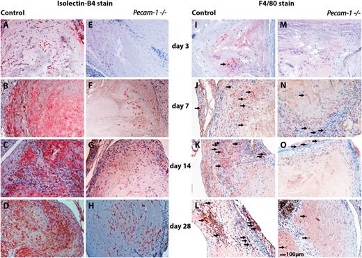 Figure 3. Immunohistochemical analyses of wild-type and Pecam-1−/− thrombi illustrating misguided vascular remodeling of thrombus resolution in the absence of PECAM-1. Isolectin-B4 immunoreactivities representing endothelial cells in wild-type (A-D) and corresponding Pecam-1−/− thrombi (E-H) are shown on days 3 (A,E), 7 (B,F), 14 (C,G), and 28 (D,H) after vena cava ligation on the left side of the panel. The right side of the panel shows F4/80 immunoreactivities representing macrophages (examples of immunopositive cells are pointed out with small arrows) in wild-type (I-L) and corresponding Pecam-1−/− thrombi (M-P) on days 3 (I,M), 7 (J,N), 14 (K,O), and 28 (L,P) after vena cava ligation. Scale bar, 100 μm.