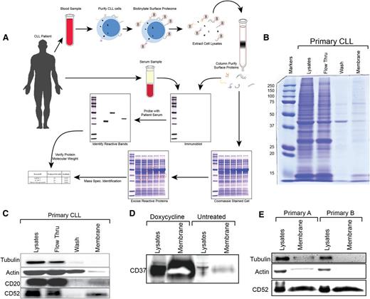 Figure 1. Schema and validation for isolation and identification of autoreactive CLL surface proteins. Panel A alone depicts a schematic representation of an idealized antigen-identification process. Primary CLL cells were surface labeled with biotin. Lysates were loaded onto streptavidin columns, and biotinylated membrane proteins were collected. Cell surface proteome aliquots were run on two identical sodium dodecyl sulfate–polyacrylamide gel electrophoresis gels. One gel was transferred to nitrocellulose and probed with autologous serum at a dilution of 1:100, probed with anti-human IgG-HRP, washed, and developed by autoradiography. Any autoreactive bands were isolated from the coomassie stained gel and subjected to mass spectroscopic protein identification. (B) A coomassie stained gel shows relative protein recovery at each step in the isolation of membrane proteins from freshly purified primary CLL B cells. (C) Immunoblot analysis of cytosolic proteins β-actin and α-tubulin as well as membrane proteins CD20 and CD52 demonstrates enrichment of membrane protein isolation from primary CLL cells. (D) MEC1 CLL cells containing a doxycycline-inducible CD37 construct were utilized to demonstrate the fidelity of cellular membrane isolation. (E) Membrane fractions from primary CLL B cells isolated from two different patients on two different days to ensure repeatable enrichment of membrane proteins.