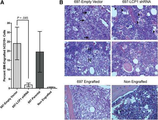 Figure 5. LCP1 is critical to bone marrow migration of leukemia in an in vivo xenotransplantation model. (A) CB17/SCID mice were engrafted with 1E7 live 697-parental, 697-Empty Vector, or 697-LCP1 shRNA cells and sacrificed on day 18. Bone marrow infiltration of GFP+human-CD19+ cells was quantified by flow cytometry. Bars depict average bone marrow infiltration of CD19+ cells. Error bars indicate standard error of the mean (B) H&E stained sections of femoral bone marrow from 697-Empty Vector (left), note the bone marrow in this photomicrograph is largely replaced by a monomorphic population of neoplastic round cells containing numerous mitotic figures (arrows). Low-magnification view of the neoplastic cell population (N), which is invading and replacing normal hematopoietic bone marrow (H), as compared with sections from 697-LCP1 shRNA (right), which depict significantly less pathology than the control group. This photomicrograph depicts normal bone marrow in a mouse from this group. Several megakaryocytes (arrowheads) are surrounded by myeloid and erythroid precursor cells. Controls (bottom row) included a mouse engrafted with the parental 697 cell line and an animal that received no xenograft.