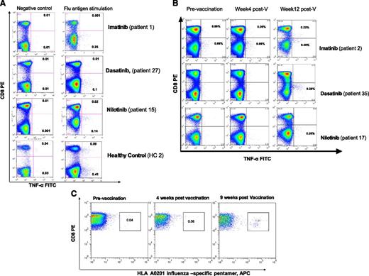 Figure 1. T-cell responses to influenza A vaccination in patients with CML on TKI and healthy controls. PBMCs collected before and 2 to 3 months postvaccination were thawed and stimulated for 24 hours with or without seasonal influenza vaccine at a final concentration of 1.5 µg/mL of hemagglutinin antigens or with phorbol 12-myristate 13-acetate (50 ng/mL) and ionomycin (2 μg/mL; Sigma Aldrich, Gillingham, United Kingdom) (positive control) for 19 hours at 37°C. Brefeldin A (10 µg/mL) (Sigma Aldrich) was added alone or with monensin (0.7 µL/mL) (BD/Pharmingen, San Diego, CA) and the degranulation marker CD107a-FITC (BD/Pharmingen). PBMCs were washed and stained with anti-CD3 and anti-CD8 antibodies, fixed/permeabilized (all BD Biosciences, Oxford, United Kingdom), and stained with anti–IFN-γ, anti–TNF-α, and anti–IL-2 antibodies (all BD/Pharmingen). Data acquisition was performed using FACSCalibur (BD Biosciences, Oxford, United Kingdom), and a minimum of 300 000 events were acquired. The threshold of positivity for cytokines and CD107a was set in order to minimize nonspecific staining in nonstimulated cells (negative control). Following vaccination, a response was considered positive if there was a minimum of 0.10% flu-specific T cells producing TNF-α or INF-γ and the percentage of antigen-specific T cells producing TNF-α or INF-γ was twofold or higher compared with prevaccination level. (A) Examples of preexisting CD8+ and CD4+ T-cell responses to influenza before vaccination in patients on TKI and a healthy control. (B) Examples of T-cell responses to influenza A vaccination in patients on TKI using IC assay. (C) Detection of influenza-specific CD8+ T cells using an HLA-A2–restricted GILGFVFTL (FluMP) pentamer: the fluorescence-activated cell sorter plot from a CML patient on dasatinib showing a robust CD8+ T-cell response to influenza vaccination is presented. Unstimulated PBMCs from HLA-A0201 patients and healthy controls were stained with HLA-A0201/GILGFVFTL (FluMP) Pro5 MHC I Pentamer (ProImmune, Oxford, United Kingdom) conjugated to APC and costained with anti–CD8-FITC (ProImmune) and anti–CD3-PerCP (BD Biosciences).
