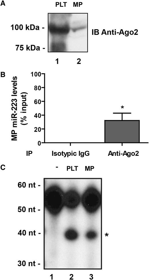 Figure 2. Platelet-derived MPs contain functional Ago2•miR-223 effector complexes. (A-C) Human platelets (PLT) were activated with thrombin (0.1 U/mL) for 60 minutes, and the MP fraction was isolated by ultracentrifugation. Unstimulated platelets served as the control.3 (A) The presence of Ago2 was assessed by immunoblot (IB) analysis using an anti-Ago2 antibody. (B) Protein extracts derived from the MP fraction were subjected to immunoprecipitation using anti-Ago2 antibody, followed by quantitative miR-223 detection by qPCR. Results were normalized by the 2^-ΔΔCt method, using RNU6 as a reference,27 and expressed as a percentage of the input (mean ± SEM; n = 4 experiments). *P < .05 vs normal isotypic IgG, which was used as an IP control (Student t test). (C) The supernatant (S100) (50 µg proteins) fraction of protein extracts derived from PLT or the MP fraction of thrombin-activated platelets were subjected to RNA target cleavage assays, using a 5′ end, 32P-labeled miR-223 RNA sensor. RNA was isolated by phenol/chloroform extraction and ethanol precipitation, separated by denaturing 8% polyacrylamide gel electrophoresis PAGE/7 M urea and visualized by autoradiography (n = 2 experiments). *The 39-nucleotide RNA product expected from Ago2-mediated endonucleolytic cleavage of the sensor. -, uncleaved 32P-labeled miR-223 RNA sensor.