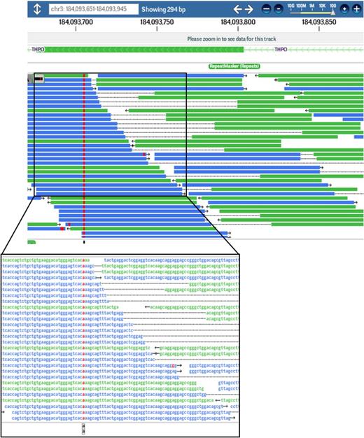 Figure 3. A novel homozygous THPO variant (c.CTG>TGT;p.Arg17Cys) was identified in both siblings affected with aplastic anemia. Screen shot of exome sequence reads (left) and DNA sequence abnormality shown on the reverse strand (red) as visualized by DNAnexus software.