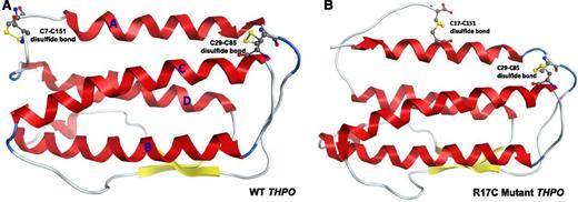 Figure 5. In silico model showing the effect of R17C mutation on disulfide bonding in THPO receptor-binding domain. (A) The THPO receptor-binding domain consists of a 4-helix bundle (red, shown as letters A-D) and a short antiparallel β sheet formed by 2 strands. The domain contains 4 highly conserved cysteine residues (C7, C29, C85, and C151), which form 2 disulfide bonds. Due to position constraints, the mutant C17 cannot form a disulfide bond with any of C7, C29, and C85 residues without disrupting the overall structure but can form a disulfide bond with C151 as shown in B.