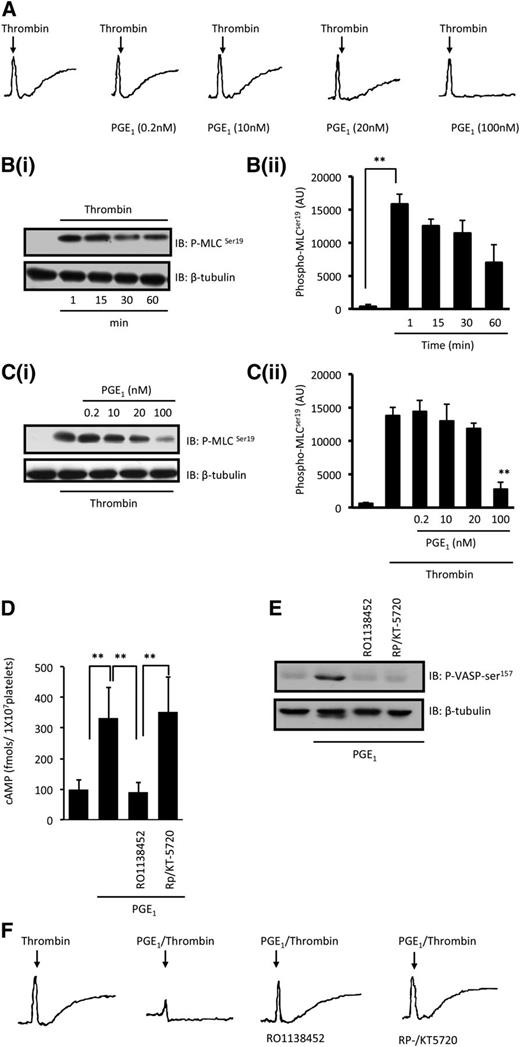 Figure 1. PGE1 modulates thrombin-induced shape change and MLC phosphorylation. (A) Washed platelets (3 × 108 platelets per milliliter) were preincubated with apyrase (2 U/mL), indomethacin (10 µM), and EGTA (1 mM) followed by stimulation with thrombin (0.05 U/mL) in the presence and absence of PGE1 (0.2 to 100 nM), and traces were recorded for 2 minutes. Shown are representative traces of 3 separate experiments. (B) Washed platelets (3 × 108 platelets per milliliter) were stimulated with thrombin (0.05 U/mL) for the indicated time points and the levels of MLCser19 were assessed by immunoblotting. (i) Representative immunoblots (IB) from 3 independent experiments. (ii) Densitometric analysis of MLCser19 phosphorylation of 3 different experiments expressed as arbitrary units (AU). **P < .01 compared with basal levels. (C) Washed platelets (3 × 108 platelets per milliliter) were stimulated with thrombin (0.05 U/mL) for 1 minute in the presence or absence of PGE1 (0.2 to 100 nM) and phospho-MLCser19 was assessed by immunoblotting. (i) Representative immunoblots from 4 independent experiments. (ii) Densitometry of MLCser19 phosphorylation from 4 different experiments. **P < .01 compared with thrombin alone. (D) Washed platelets (2 × 108 platelets per milliliter) were treated with PGE1 (100 nM) in the presence and absence of RO1138452 (1 µM) or Rp-8-CPT-cAMPS (RP; 500 µM)/KT-5720 (20 µM), and cAMP levels were measured. Data are mean ± standard error of the mean of 3 experiments and are expressed as fmol cAMP/1 × 107 platelets. **P < .01 compared with basal levels. (E) Same as in (D), except platelets were lysed and immunoblotted for phospho-VASP-ser157. Blot is representative of 5 independent experiments. (F) Same as in (A), except that experiments were performed in the presence of RO1138452 (1 µM) or Rp-8-CPT-cAMPS (500 µM)/KT-5720 (20 µM). Shown are representative traces of 3 separate experiments.