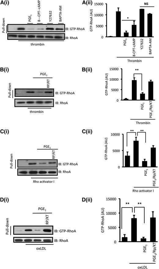 Figure 3. cAMP/PKA signaling modulates the activation of RhoA. (A) Washed platelets (5 × 108 platelets per milliliter) were stimulated with thrombin (0.05 U/mL) for 1 minute in the presence or absence of Y27632 (10 µM), BAPTA-AM (20 µM), 8-CPT-6-Phe-cAMP (50 µM), or PGE1 (100 nM), and activated RhoA (GTP-RhoA) was assessed by using a pull-down assay with Rhotekin-RBD beads. (i) Representative immunoblots from 3 independent experiments. (ii) Densitometric analysis of activated RhoA (GTP-RhoA) of 3 different experiments. *P < .05 compared with thrombin only. (B) Same as in (A), except platelets were treated with PKA inhibitors Rp-8-CPT-cAMPS (500 µM)/KT-5720 (20 µM) for 15 minutes prior to addition of thrombin and PGE1. (C) Same as in (B), except platelets were treated with Rho Activator I (30 µM) for 2 minutes instead of thrombin. (D) Same as in (B), except platelets were treated with oxLDL (50 μg/mL) for 15 seconds instead of thrombin.