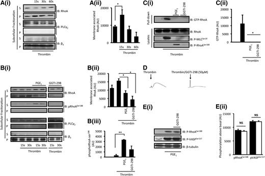 Figure 5. Inhibition of thrombin-stimulated membrane localization of RhoA by PGE1. (A) Washed platelets (5 × 108 platelets per milliliter) were stimulated with thrombin for 15 to 60 seconds, and reactions were terminated by the addition of fractionation buffer and snap frozen. Samples were separated into soluble (S) and particulate (P) fractions by ultracentrifugation and were analyzed for the presence of RhoA, PLCγ2, and integrin β3 by immunoblotting. (i) Shown are representative blots of 5 independent experiments. (ii) Densitometry for RhoA in the particulate fraction from 5 different experiments. *P < .05 unstimulated compared with thrombin (15 seconds). (B) Washed platelets (5 × 108 platelets per milliliter) were stimulated with thrombin for 15 and 30 seconds in the presence and absence of PGE1 (100 nM) or GGTI-298 (50 µM). Soluble and particulate fractions were analyzed for the presence of RhoA, RhoA-ser188, PLCγ2, and integrin β3 by immunoblotting. (i) Representative blots of 4 independent experiments. (ii) Densitometry of the presence of RhoA in the particulate fractions at 15 seconds. *P < .05 thrombin compared with thrombin/PGE1 or thrombin/GGTI-298 (15 seconds). (iii) Densitometry of the presence of phospho-RhoAser188 in the soluble fraction at 15 seconds compared with untreated cells. **P < .01 thrombin compared with thrombin/PGE1. (C) Washed platelets (5 × 108 platelets per milliliter) were stimulated with thrombin (0.05 U/mL) for 1 minute in the presence and absence of PGE1 (100 nM) or GGTI-298 (50 µM), and reaction was stopped with lysis buffer. Lysates were incubated with Rhotekin-RBD beads (25 ng) for 90 minutes at 4°C. After washing the beads, the level of activated RhoA (GTP-RhoA) was assessed by immunoblotting. Lysates remaining after pull-down assay were used to examine phospho-RhoA-ser188, VASP-ser157, and MLC-ser19. (i) Representative immunoblots from 3 independent experiments. (ii) Densitometry of RhoA-GTP from 3 different experiments. *P < .05 thrombin alone compared with thrombin/PGE1 and GGTI-298. (D) Washed platelets (3 × 108 platelets per milliliter) were preincubated with apyrase (2 U/mL), indomethacin (10 µM), and EGTA (1 mM) followed by stimulation with thrombin (0.05 U/mL) in the presence and absence of GGTI-298 (50 μM), and traces were recorded for 2 minutes. Shown are representative traces of 3 separate experiments. (E) Washed platelets (5 × 108 platelets per milliliter) was treated with PGE1 (100 nM) for 1 minute in the presence (white bars) and absence (black bars) of GGTI-298 (50 µM), and the phosphorylation of RhoA and VASP was assessed by immunoblotting. (i) Representative immunoblots of phospho-RhoA-ser188 and phospho-VASP-ser157 from 3 independent experiments. (ii) Densitometry of phosphorylation of RhoA from 3 different experiments. NS, not significant.
