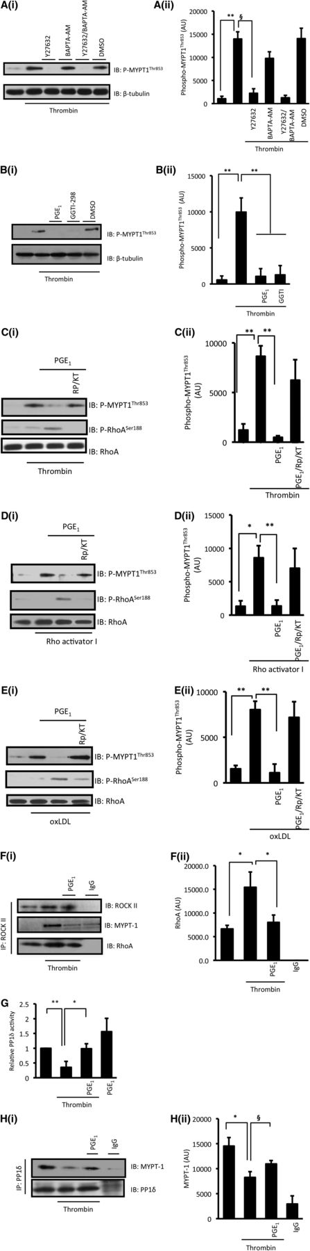 Figure 6. PGE1 modulates the formation of a RhoA/ROCK/MYPT1 signaling complex. (A) Washed platelets (5 × 108 platelets per milliliter) were stimulated with thrombin (0.05 U/mL) for 1 minute in the presence or absence of Y27632 (10 µM) and BAPTA-AM (20 µM); phospho-MYPT1-thr853 was then assessed by immunoblotting. (i) Representative immunoblots from 3 independent experiments. (ii) Densitometry of phospho-MYPT1-thr853 from 3 different experiments. **P < .01 thrombin compared with basal levels; §P < .05 thrombin alone compared with Y27632. (B) Same as in (A), except platelets were treated with PGE1 (100 nM) or GGTI-298 (50 µM) prior to stimulation with thrombin, and phospho-MYPT1-thr853 was assessed by immunoblotting. (i) Representative immunoblots from 3 independent experiments. (ii) Densitometry of MYPT1-thr853 phosphorylation of 3 different experiments. **P < .01 thrombin alone compared with thrombin/PGE1 and GGTI-298. (C) Washed platelets (5 × 108 platelets per milliliter) were stimulated with thrombin (0.05 U/mL) for 1 minute in the presence or absence of PGE1 (100 nM), and phospho-MYPT1-thr853 was assessed by immunoblotting. In some cases, platelets were also treated with Rp-8-CPT-cAMPS (500 µM)/KT-5720 (20 µM). (i) Representative immunoblots from 3 independent experiments. (ii) Densitometric analysis of phospho-MYPT1thr853 of 3 different experiments. *P < .05 compared with thrombin only. (D) Same as in (B), except platelets were treated with Rho Activator I (30 µM) for 2 minutes instead of thrombin. (E) Same as in (B), except platelets were treated with oxLDL (50 μg/mL) for 15 seconds instead of thrombin. (F) Washed platelets (8 × 108 platelets per milliliter) were stimulated with thrombin (0.05 U/mL) for 1 minute in the presence and absence of PGE1 (100 nM). Reaction was stopped with lysis buffer and ROCK1 was immunoprecipitated. The immunoprecipitates were then immunoblotted for the presence of ROCK2, MYPT1, and RhoA. (i) Representative immunoblots of 4 independent experiments. (ii) Densitometric analysis of amount of RhoA present in the immunoprecipitates. *P < .05 thrombin compared with thrombin alone. (G) Same as in (F), except PP1δ was immunoprecipitated and was incubated for 1 hour at room temperature with 5 mM para-nitrophenyl phosphate, and absorbance was measured at 405 nm. Graph is representative of 5 different experiments. **P < .01 thrombin compared with basal activity; *P < .05 thrombin alone compared with thrombin with PGE1. (H) Samples from (G) were immunoblotted for PP1δ and MYPT1. (i) Representative immunoblots of 4 independent experiments. (ii) Densitometric analysis of total MYPT1 of 4 different experiments. *P < .05 thrombin compared with basal levels; §P < .05 thrombin alone compared with thrombin with PGE1.