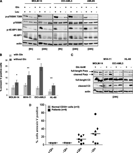 Figure 1. Glutamine removal inhibits mTORC1 activity and induces apoptosis in AML cells. (A) The MOLM-14 and OCI-AML3 cell lines, and primary AML cells from a representative patient, were cultured for 6 or 24 hours with or without 4 mM glutamine (Gln) and/or 0.4 mM leucine (Leu). Cells were lysed in Laemmli buffer and western blotting was performed to analyze the p70S6K T389 and 4E-BP1 S65 phosphorylation status. (B) MOLM-14, OCI-AML3, MV4-11, and HL-60 cell lines were cultured with or without Gln for 24 hours and apoptosis was quantified by flow cytometry analysis of Annexin-V binding. (C) The indicated cell lines were cultured for 24 hours with or without glutamine and then assessed for caspase-3 and PARP cleavage by western blotting. (D) Normal CD34+ cell were obtained from 3 healthy allogeneic transplant donors after positive sorting and primary AML cells from 8 AML patients were also tested. Cells were cultured 48 hours with or without glutamine (4 mM), and the apoptotic responses were quantified by flow cytometry analysis of Annexin-V binding.