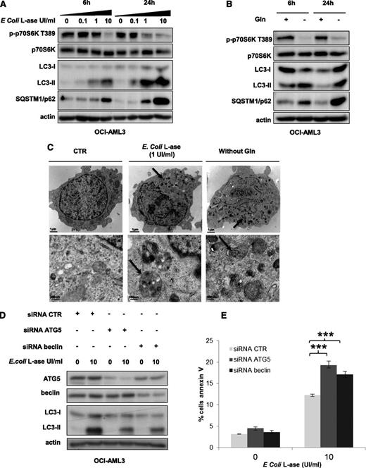 Figure 6. l-ase induces strong protective autophagy in AML cells. (A-B) OCI-AML3 cells were cultured for 6 or 24 hours in 10% FCS MEM with or without 0.1, 1, and 10% FCS MEM with or without 0.1, 1, or 10 UI/mL of E coli l-ase and with or without Gln as indicated. Autophagy was detected by western blotting using anti-LC3b and p62/SQSTM1 antibodies. (C) Representative electron micrographs of OCI-AML3 cells collected after 24 hours of culture in MEM with or without E coli l-ase (1 UI/mL) and without glutamine. Arrows indicate autophagic vesicles. Upper and lower panels show 2 different scales. (D) OCI-AML3 cells were transfected with anti-ATG5 or anti-beclin siRNAs using the Amaxa nucleofector kit. Two days after transfection, cells were cultured for 24 hours with or without E coli l-ase at 10 UI/mL and western blotting was performed to verify ATG5 and Beclin knockdowns, respectively. (E) Viability was measured in OCI-AML3 cells (transfected or not with anti-ATG5 or anti-Beclin siRNA and treated or not with E coli l-ase) by flow cytometry analysis of Annexin V fixation. The histograms shown represent the mean values of 3 independent experiments.
