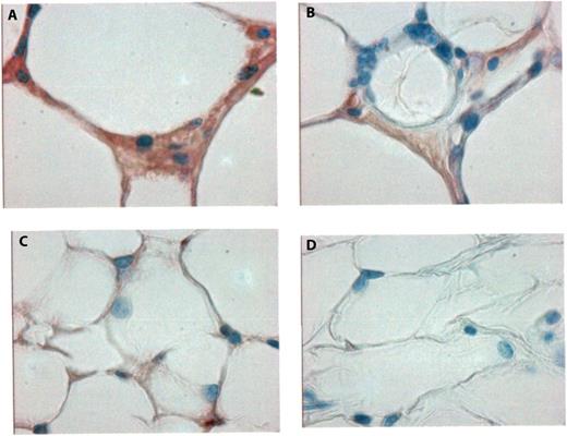 Figure 4. Fibrin deposition in adipose tissue in obesity. Immunohistochemical staining for fibrin in paraffin sections of adipose tissue, showing increased fibrin deposition (reddish-brown color) in obese mice (A,B) compared with lean mice (C). (D) Negative control staining without the primary anti-fibrin antibody. Slides were counterstained with hematoxylin. Original magnification in all panels, ×400.