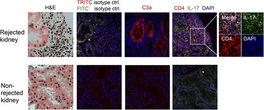 Figure 3. Biopsies from human kidney transplants with acute T-cell–mediated rejection are characterized by high tubular C3a production and IL-17 infiltration. Histology samples from acutely rejecting (top panels) and nonrejecting (bottom panels) kidney transplants were stained with indicated Abs and analyzed by confocal fluorescence microscopy. Results shown are representative of histology data obtained from samples of 3 patients with acute kidney rejection and 2 patients without signs of kidney rejection (×60 magnification for the 8 large panels, and ×100 magnification for the inset). ctrl, control; FITC, fluorescein isothiocyanate; H&E, hematoxylin and eosin; TRITC, tetramethylrhodamine isothiocyanate.