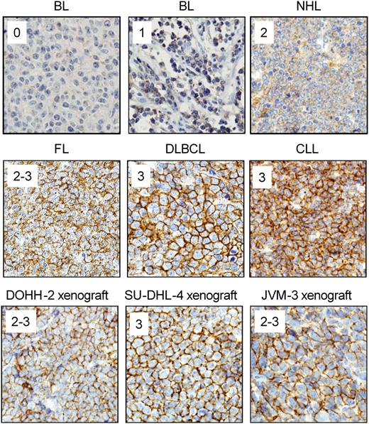 Figure 1. Examples of CD37 staining on human lymphoma samples. Sections from paraffin-embedded lymphoma tissue and xenograft tumors were stained with anti-CD37 antibody as described for Table 1 and staining intensity was scored as follows: 0 = negative; 1 = weak; 2 = moderate; and 3 = strong. Lymphoma samples representing each intensity level and sections from xenograft tumor models used in efficacy studies are shown. All images were acquired on an Olympus BX51 light microscope at ×40 magnification with an Olympus DP71 camera and DP Controller software (v3.2.1.276).