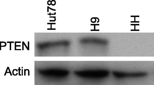 Figure 1. PTEN protein in CTCL cell lines. Western blotting analysis revealing the PTEN level in CTCL cell lines. No PTEN protein is detected in HH cells, in agreement with their PTEN−/− status.